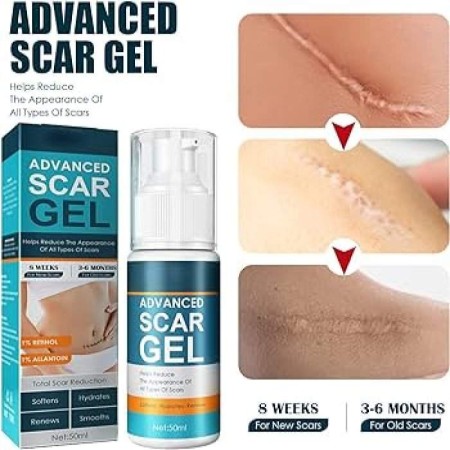 Advanced Scar Gel